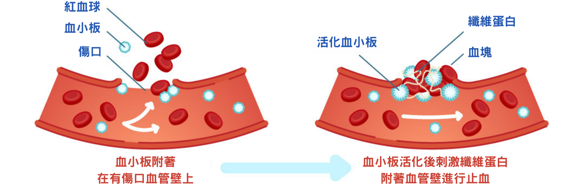 血小板示意圖.png